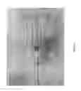 Fig. 07 - Device for Discharging Toxic Gases