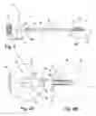 Fig. 04 - MATERIAL REMOVAL CATHETER AND METHOD