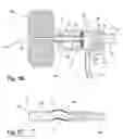 Fig. 06 - MATERIAL REMOVAL CATHETER AND METHOD