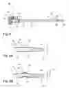 Fig. 09 - MATERIAL REMOVAL CATHETER AND METHOD