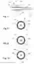 Fig. 10 - MATERIAL REMOVAL CATHETER AND METHOD