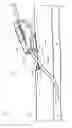 Fig. 02 - System for anchoring medical devices