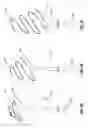 Fig. 05 - Pleurodesis device and method