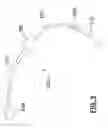 Fig. 06 - Pleurodesis device and method