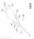 Fig. 07 - Pleurodesis device and method