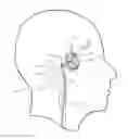 Fig. 01 - Steerable intravascular anchor and method of operation