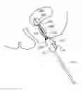 Fig. 01 - Cuff-resistant anchoring balloon for medical device