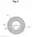Fig. 03 - Device for protecting the rectal anastomosis