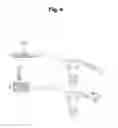 Fig. 05 - Device for protecting the rectal anastomosis