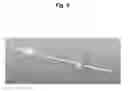 Fig. 06 - Device for protecting the rectal anastomosis