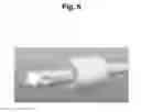 Fig. 07 - Device for protecting the rectal anastomosis