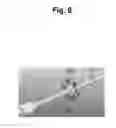 Fig. 09 - Device for protecting the rectal anastomosis