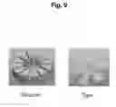 Fig. 10 - Device for protecting the rectal anastomosis