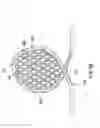 Fig. 06 - Methods and devices for inhibiting tissue growth from restricting a strain relief loop of an implantable medical lead