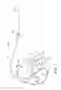 Fig. 02 - Lead delivery device and method