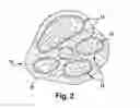 Fig. 03 - Implantable cuff and method for functional electrical stimulation and monitoring