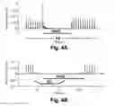 Fig. 06 - Therapy delivery devices and methods for non-damaging neural tissue conduction block