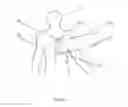 Fig. 04 - Method and device for reducing muscle tension through electrical manipulation