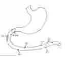 Fig. 01 - Swallowable capsule and method for stimulating incretin production within the intestinal tract