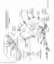 Fig. 04 - Swallowable capsule and method for stimulating incretin production within the intestinal tract