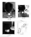 Fig. 05 - Transdermal electrical stimulation devices for modifying or inducing cognitive state