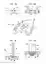 Fig. 06 - SPG stimulation