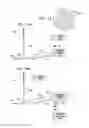Fig. 09 - SPG stimulation