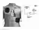 Fig. 01 - METHOD AND APPARATUS FOR DETECTING A SHOCK APPLIED TO A PATIENT DURING CPR