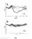 Fig. 06 - Optimising current direction and intensity of transcranial magnetic stimulation