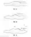 Fig. 02 - Golf ball aerodynamic configuration