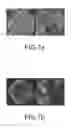 Fig. 06 - POROUS COMPOSITE PARTICULATE MATERIALS, METHODS OF MAKING AND USING SAME, AND RELATED APPARATUSES