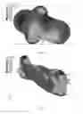 Fig. 07 - HELICAL EXTRUSION OF UNSYMMETRICAL MULTI-LOBED CATALYST SUPPORTS