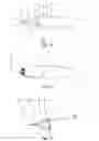 Fig. 06 - Applicator for in particular manually controlled application of a light-curable composite material and arrangement of a light source on the applicator