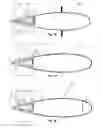 Fig. 08 - Applicator for in particular manually controlled application of a light-curable composite material and arrangement of a light source on the applicator