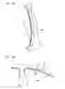Fig. 08 - Method of welding overlapped portion, method of manufacturing overlap-welded member, overlap-welded member, and automotive part