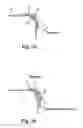 Fig. 04 - Attachment Device and Method of Use Thereof