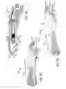 Fig. 06 - Safety cutter apparatus