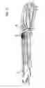 Fig. 16 - Safety cutter apparatus