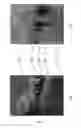 Fig. 08 - PRESS MOLDING WITH REINFORCING RIB AND MANUFACTURING METHOD THEREFOR