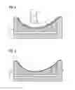 Fig. 04 - Mold for manufacturing a component