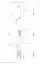 Fig. 03 - METHOD FOR AVOIDING ENTRAPMENT OF AIR BUBBLES IN A LENS FORMING MATERIAL AND APPARATUS FOR CARRYING OUT THE METHOD