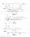 Fig. 02 - Method for determining the depth of tread of a vehicle tire with a tire module arranged on the inner side of the tire