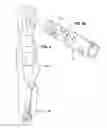 Fig. 05 - SYSTEM AND DEVICE FOR MECHANICALLY EXTENDING AND RETRACTING LANDING GEAR OF A SEMITRAILER OR A CHASSIS