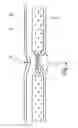 Fig. 03 - SOUND PROTECTION DEVICE FOR SEPARATING OFF A SPACE IN AN AIRCRAFT