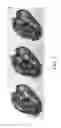 Fig. 04 - Crystal encapsulated nanoparticles methods and compositions