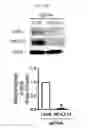 Fig. 09 - Composition for preventing or treating fracture or osteoporosis using slit-robo system