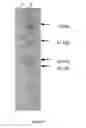 Fig. 03 - Humanized antibodies to cluster of differentiation 3 (CD3)