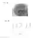 Fig. 02 - CELLS FOR THERAPY OF THE HEART, METHOD OF OBTAINING A CELL PREPARATION, AND CELL PREPARATION