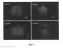 Fig. 07 - Three dimensional matrix for cancer stem cells
