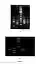 Fig. 03 - XYLOSE FERMENTING YEAST CONSTRUCTED USING A MODIFIED GENOME SHUFFLING METHOD